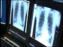 X-rays being shown on high resolution computer screens